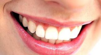 Картинка по теме - как лечить зубной камень