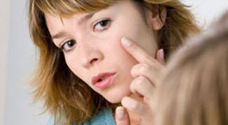 Картинка по теме - как лечить гнойные прыщи