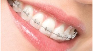 Картинка по теме - как изменить прикус