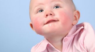 Картинка по теме - как лечить детский диатез