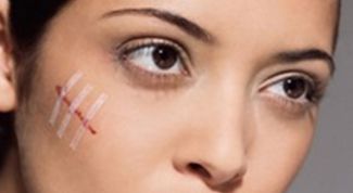 Картинка по теме - как избавиться от рубцов и шрамов