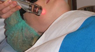 Картинка по теме - как избавиться от чёрной бороды