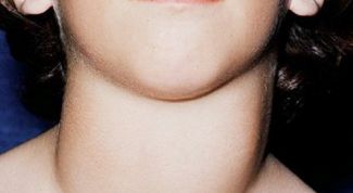 Картинка по теме - как избавиться от зоба