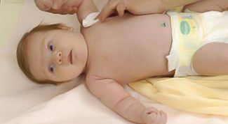 Картинка по теме - как обработать пупочную ранку