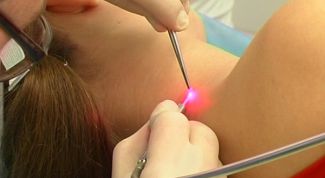 Картинка по теме - как избавиться от красных родинок