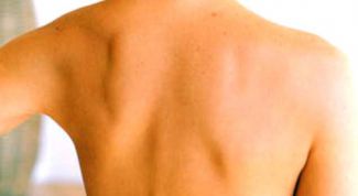 Картинка по теме - как лечить пояснично-крестцовый отдел