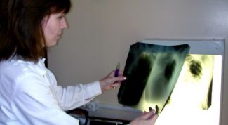 Картинка по теме - как защититься от туберкулеза