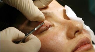 Картинка по теме - как поднять верхнее веко