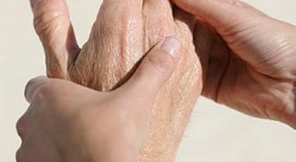 Картинка по теме - как избавиться от артрита