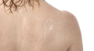 Картинка по теме - как исправить сутулость