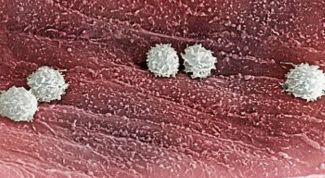 Картинка по теме - как повысить количество лейкоцитов в крови