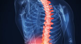 Картинка по теме - как избавиться от хандроза