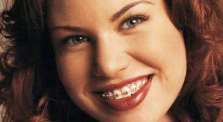 Картинка по теме - как исправить щели между зубами