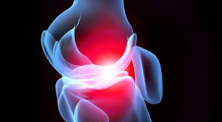 Картинка по теме - как вправлять кости