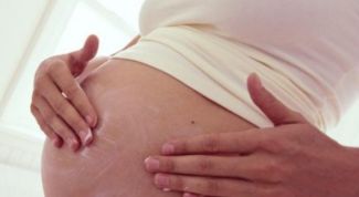 Картинка по теме - как предотвратить появление растяжек