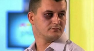 Картинка по теме - как избавиться от фингала под глазом