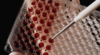 Картинка по теме - как избавиться от трихомонад