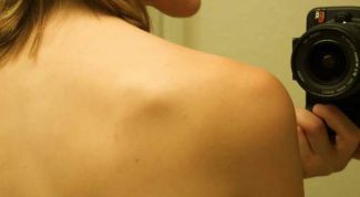 Картинка по теме - как скрыть родинку