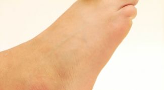 Картинка по теме - как вывести грибок на ногах