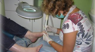 Картинка по теме - как удалить стержневую мозоль