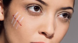 Картинка по теме - как убрать шрамы и рубцы