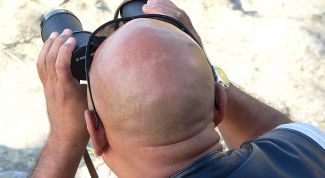 Картинка по теме - как избежать облысения