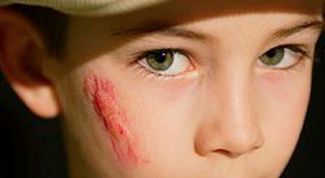 Картинка по теме - как заживить шрам