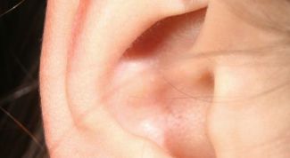 Картинка по теме - как избавиться от черных точек в ушах