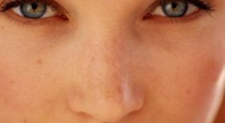 Картинка по теме - как остановить рост родинок