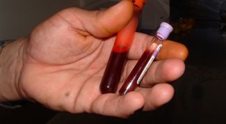 Картинка по теме - как повысить количество тромбоцитов