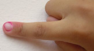 Картинка по теме - как лечить паронихию