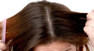 Картинка по теме - как устранить перхоть