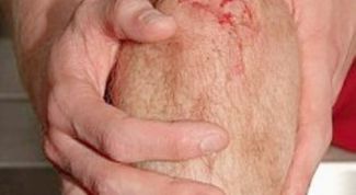 Картинка по теме - как лечить коленный синовит