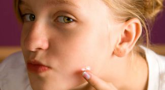 Картинка по теме - как прижигать прыщи