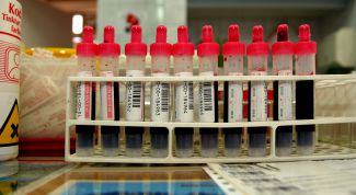 Картинка по теме - как определить краснуху