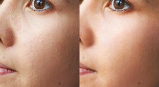 Картинка по теме - как делать ретушь в фотошопе