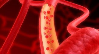 Картинка по теме - как сделать сосуды эластичными