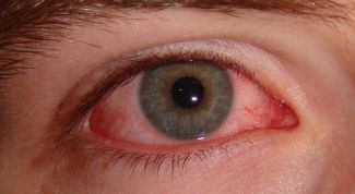Картинка по теме - как избавиться от красных сосудов в глазах