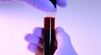 Картинка по теме - как лечить повышенный билирубин