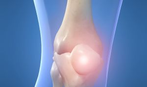 Картинка по теме - как справиться с артритом