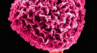 Картинка по теме - как удалить плесень с обоев