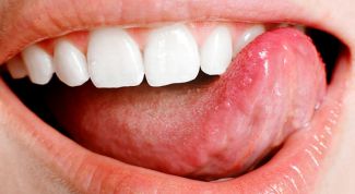 Картинка по теме - как определить заболевания по языку