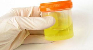 Картинка по теме - как понять результаты анализа мочи