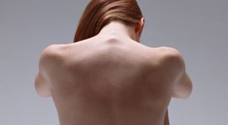 Картинка по теме - как лечить остеохондроз шеи