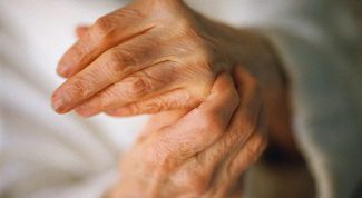 Картинка по теме - как лечить артрит рук