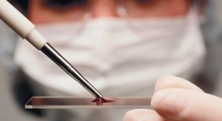 Картинка по теме - как обнаружить спид