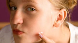 Картинка по теме - как отбелить пятна от прыщей