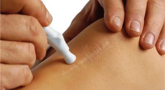 Картинка по теме - как уменьшить шрам