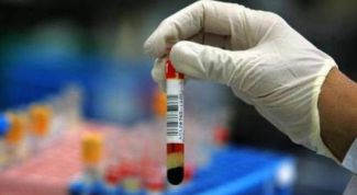 Картинка по теме - как снизить уровень креатинина в крови