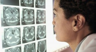 Картинка по теме - как определить опухоль мозга